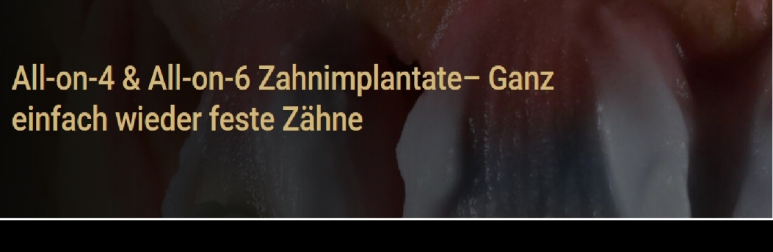 premium zahnimplantate Wien Cover Image